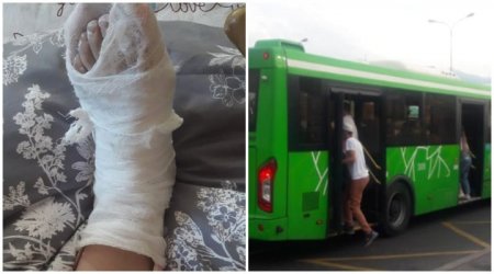 Сломала ногу в общественном транспорте жительница Караганды